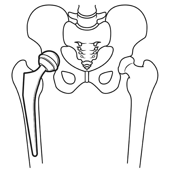 bikertek_body-augments_cornering-ubj29_detail1.jpg